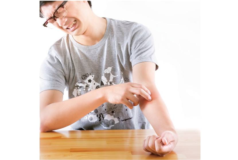 日焼け直後は脱毛禁止