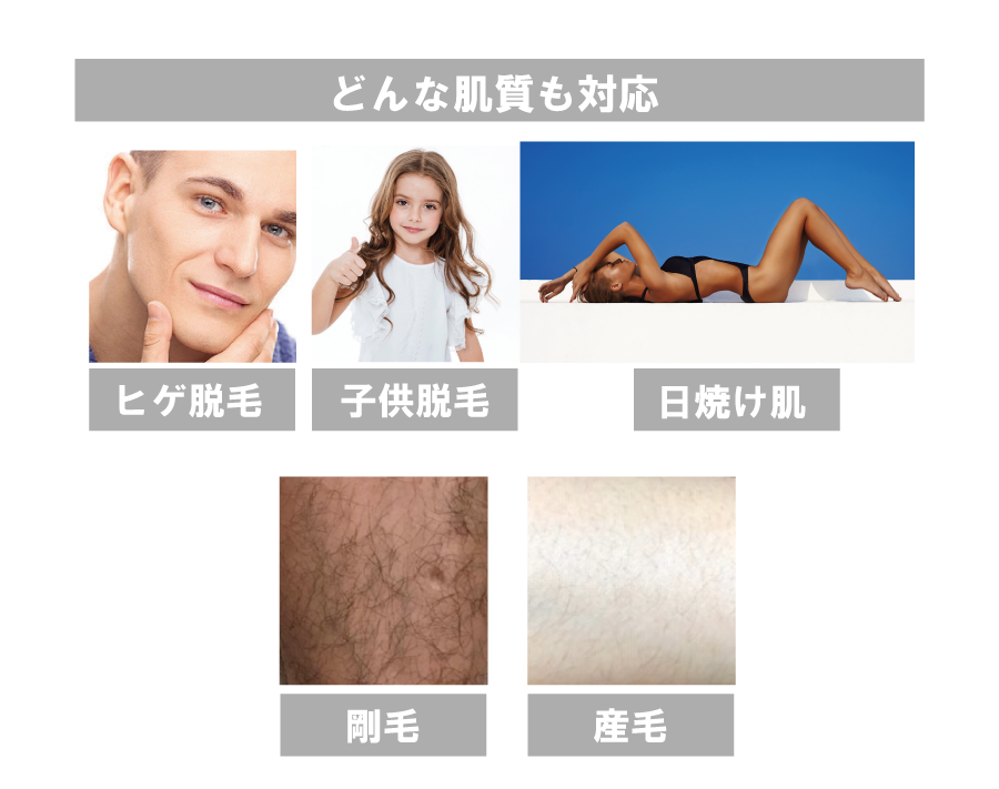 ペガサスプロはどんな肌質にもOK