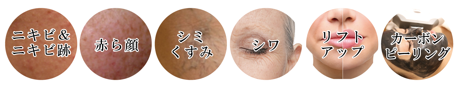 ペガサスプロEライト対応メニュー